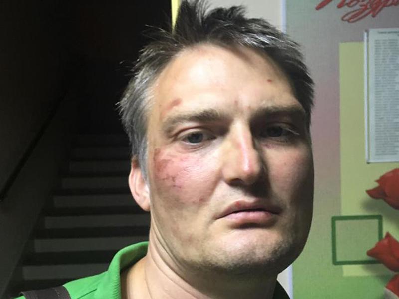 Адвокат Михаил Беньяш зафиксировал ссадины на своем лице еще в прошлом году. В октябре 2019-го суд огласил ему приговор по делу о насилии над полицейскими. Юриста задержали осенью 2018-го на митинге в Краснодаре. Пока его везли в ОВД, Беньяш ударил одного правоохранителя в лицо, а другого укусил за руку, утверждали в СКР. Сам адвокат обвинения отрицал, говорил, что это его избили силовики. В защиту обвиняемого выступили сотни адвокатов по всему миру. В итоге суд признал его виновным и назначил 30 000 руб. штрафа.